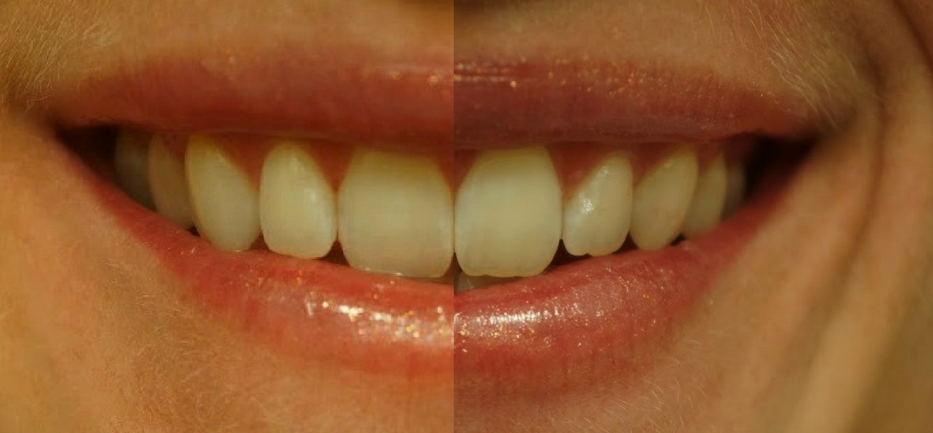 Finding Time for Self-Care with Smile Brilliant