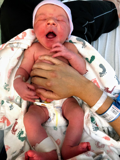 William yawning in his diaper at the hospital